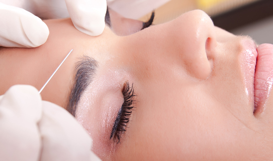 Rellenos Inyectables